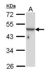 Cytokeratin 33B antibody [N1C1
