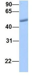 LRRC17 antibody, Internal