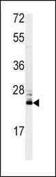 MSRA antibody, N-term