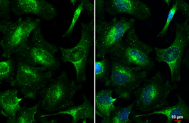 VPS35 antibody [C3], C-term