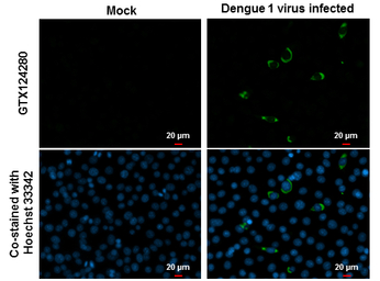 Dengue virus NS1 protein antib