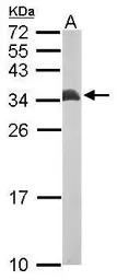 ETFB antibody [N1C3]