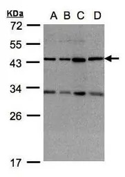 DNAJC17 antibody [N1C2]