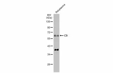 C9 antibody [N2C2-2], Internal