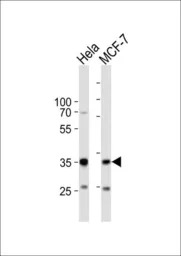 SNAI1 antibody, N-term