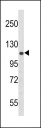 PERK antibody, N-term