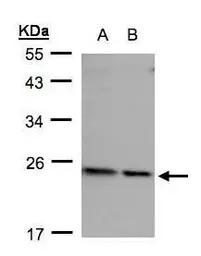 RPL17 antibody [N1C3]