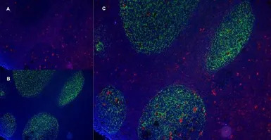 CD21 antibody [LB21]