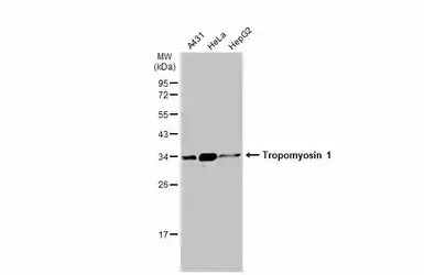 Tropomyosin 1 antibody