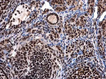 BAT1 antibody [N1C2]