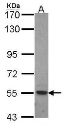 ROR alpha antibody [C3], C-ter