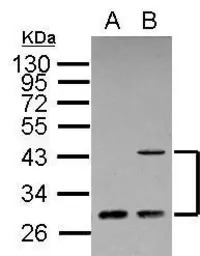 ING1 antibody [C1C3]