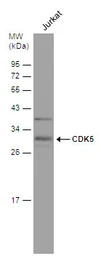 CDK5 antibody [C2C3], C-term