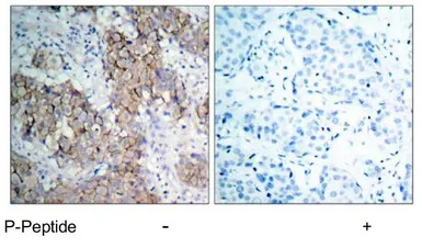 IGF1R (phospho Tyr1131) / Insu