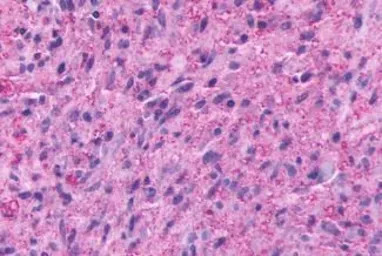 TM7SF1/GPR137B antibody