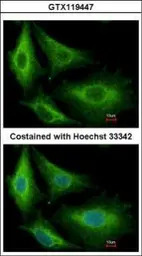 Glutathione S-transferase kapp