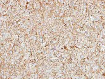 HEBP1 antibody [N1C3]