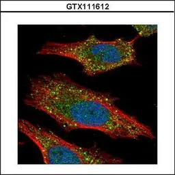 AKT2 antibody