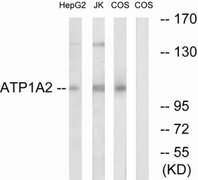 Sodium Potassium ATPase alpha 