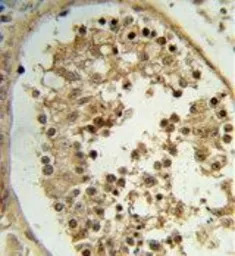 ELOVL2 antibody, N-term