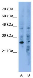 GNB1L antibody, C-term