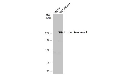 Laminin beta 1 antibody