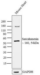 Sarcalumenin antibody [XIIC4]