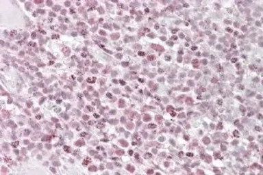 Ikaros antibody, Internal