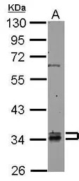 RABGGTB antibody