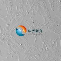 人乳腺癌成纤维细胞永生化 