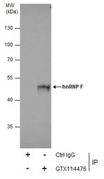 hnRNP F antibody [N1N3]