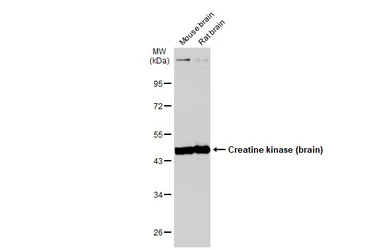 Creatine kinase (brain) antibo