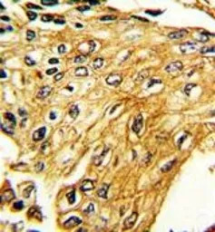 Interferon gamma Receptor 2 an