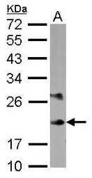 MLC1SA antibody [N1C3]