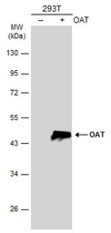 OAT antibody [N1C3]