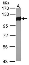 alpha Actinin 3 antibody