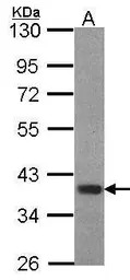 FOXB1 antibody [C2C3], C-term