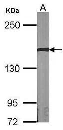 AUTS2 antibody [N3C1], Interna