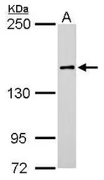 ROCK1 antibody [N1N2], N-term