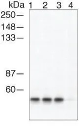 beta Arrestin 1 (phospho Ser41