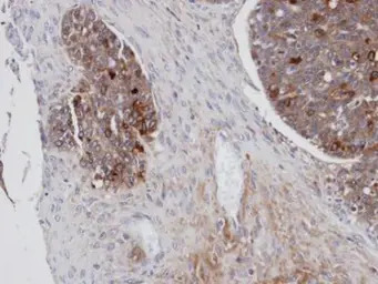 Mesothelin antibody [N1C2]