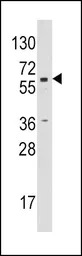 Aromatase antibody, C-term