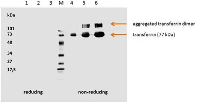 Transferrin antibody [HTF-14]