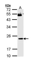 RAP1B antibody