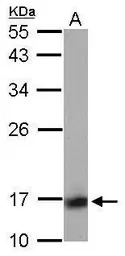 Calcineurin B antibody