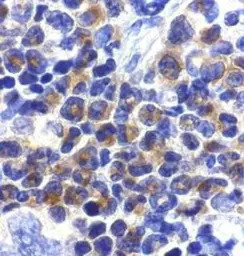 DAP Kinase 2 antibody