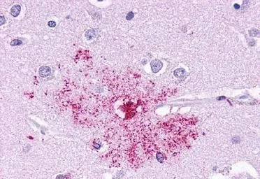 Leukotriene B4 Receptor antibo