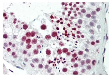 TNP1 antibody, N-term