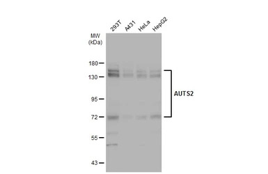 AUTS2 antibody [N3C1], Interna