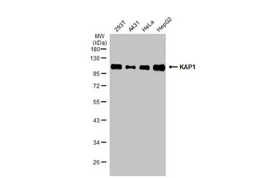 KAP1 antibody [N3C2], Internal